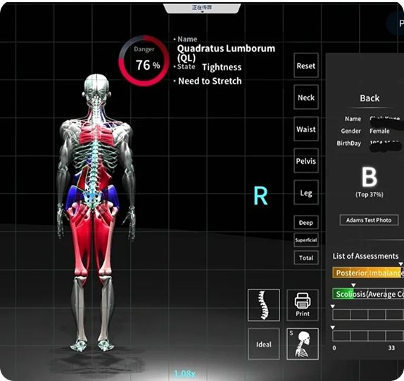 Digital skeletal analysis with muscle tension indicators.