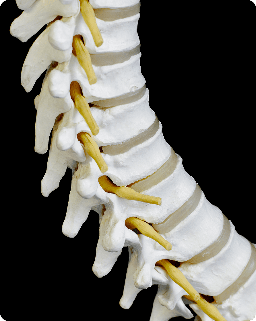 Human spine model with nerves visible.