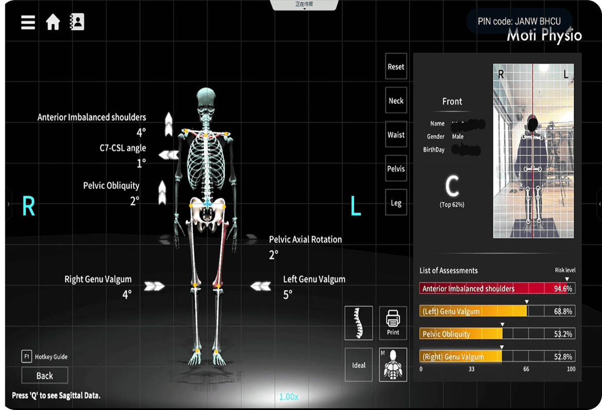 Digital skeletal posture analysis display.