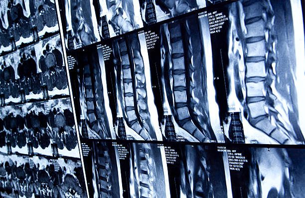 Close-up of X-ray film strips arranged on a lightbox.