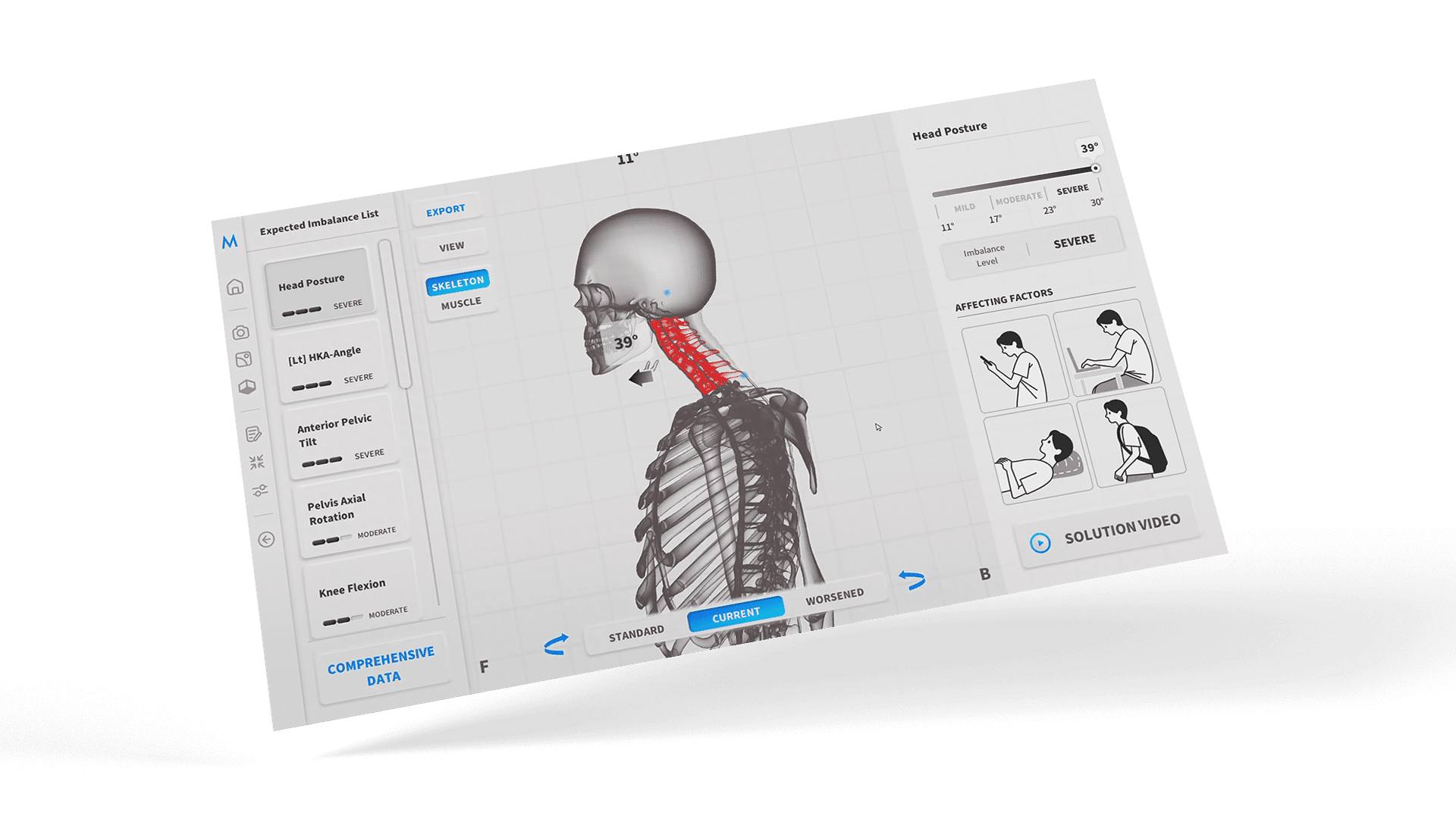 motiphysio_sw_image_01_en